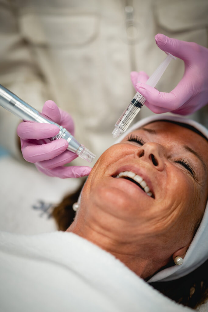 Microneedling behandeling van Mediskin Edegem